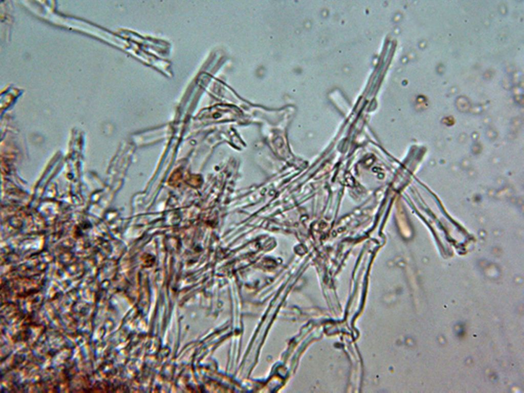 ¿Hyphodontia microspora?